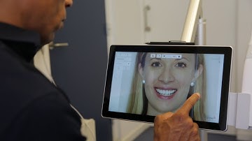 3Shape TRIOS MOVE and TRIOS Smile Design – “It makes it so easy to be an architect.”