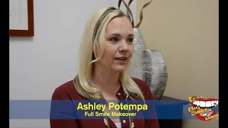 Ashely Potempa Full Smile Makeover