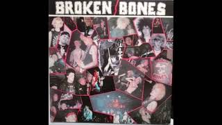 Watch Broken Bones Never Say Die video