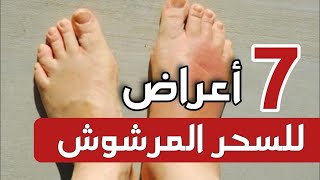 أعراض السحر المرشوش تسمعها لأول مرة بالتفصيل أخطر وأكثر الأسحار انتشارا/مدينة العلم