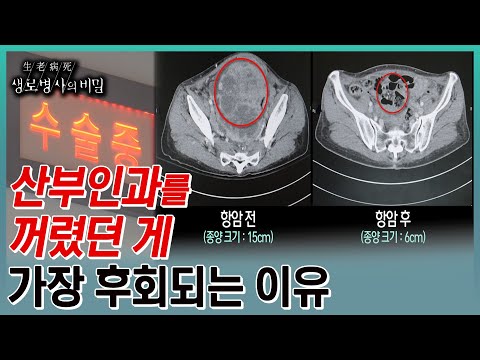 난소암, 첫수술이 생존율을 결정한다는데...수술과 함께 진단, 치료법이 결정되는 난소암과의 사투 (KBS 20230802 방송)