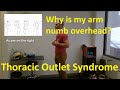 Why does my arm go numb when I reach overhead? Thoracic outlet syndrome considerations.