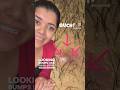 Pimples After Shaving DrCuterus Explains Pimples After Shaving DrCuterus Explains