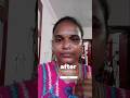 Kushboo Mam Faceoil 30day Completed Trending Skincare Faceoil Shorts Youtubeshorts