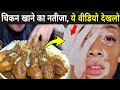 चिकन खाने वाले ये वीडियो जरूर देखे | Why Chicken Is So Cheap ?