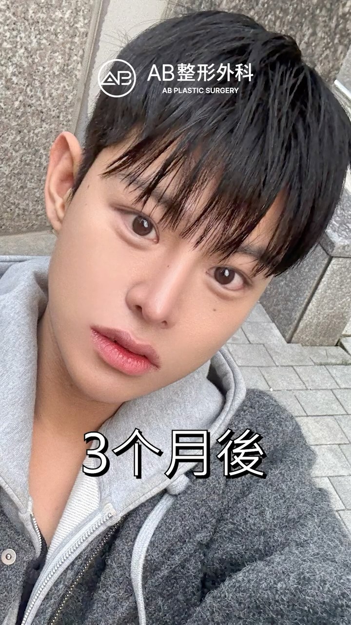 臉大又胖的男生，變成超帥型男 #shorts