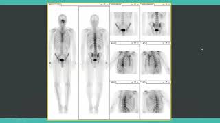 Crash course in nuclear medicine for radiology exam preparation screenshot 1