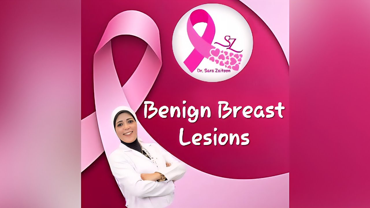 Benign Breast Lesions By Dr Sara Zaitoon