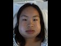 JAW SURGERY PROGRESS 9 MONTHS LATER 