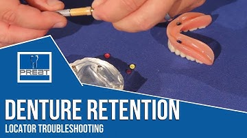Locator Troubleshooting - Fixing Denture Retention Issues By PREAT Corporation