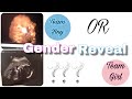 GENDER REVEAL VLOG | ITS A ..... || YOU WONT BELIEVE IT