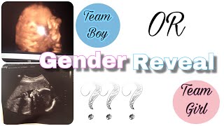 GENDER REVEAL VLOG | ITS A ..... || YOU WONT BELIEVE IT