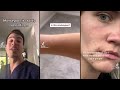 Epidemiologist Answers Common Monkeypox Questions | WIRED