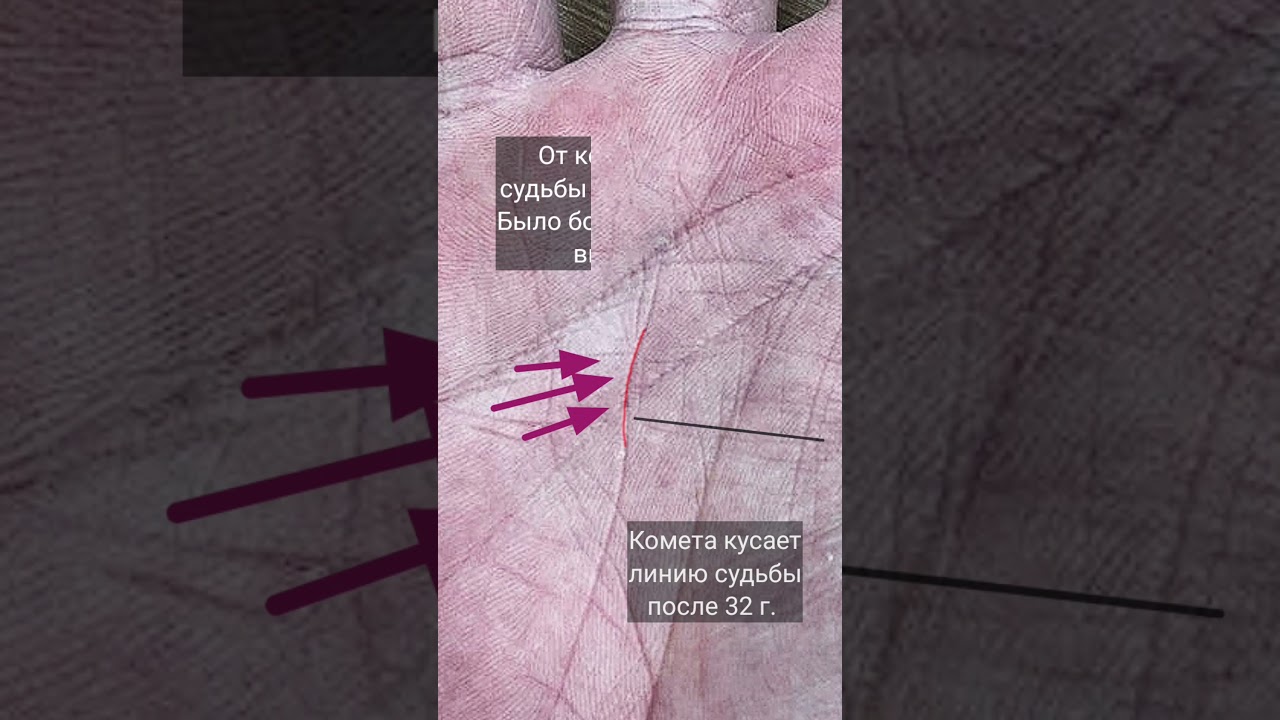 Сложный период на линии судьбы