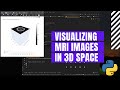 Visualization Of MRI Cross-sections of a Human Brain | Python | Plotly | Dash