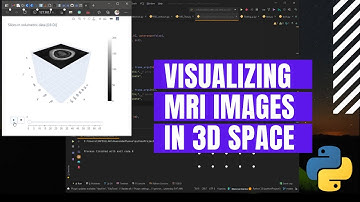 Visualization Of MRI Cross-sections of a Human Brain | Python | Plotly | Dash