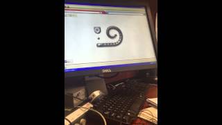 Cochlear Implant Mapping Part 1