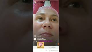 Хиджама на лицо.Подготовительный этап Хиджама на лицо.Подготовительный этап