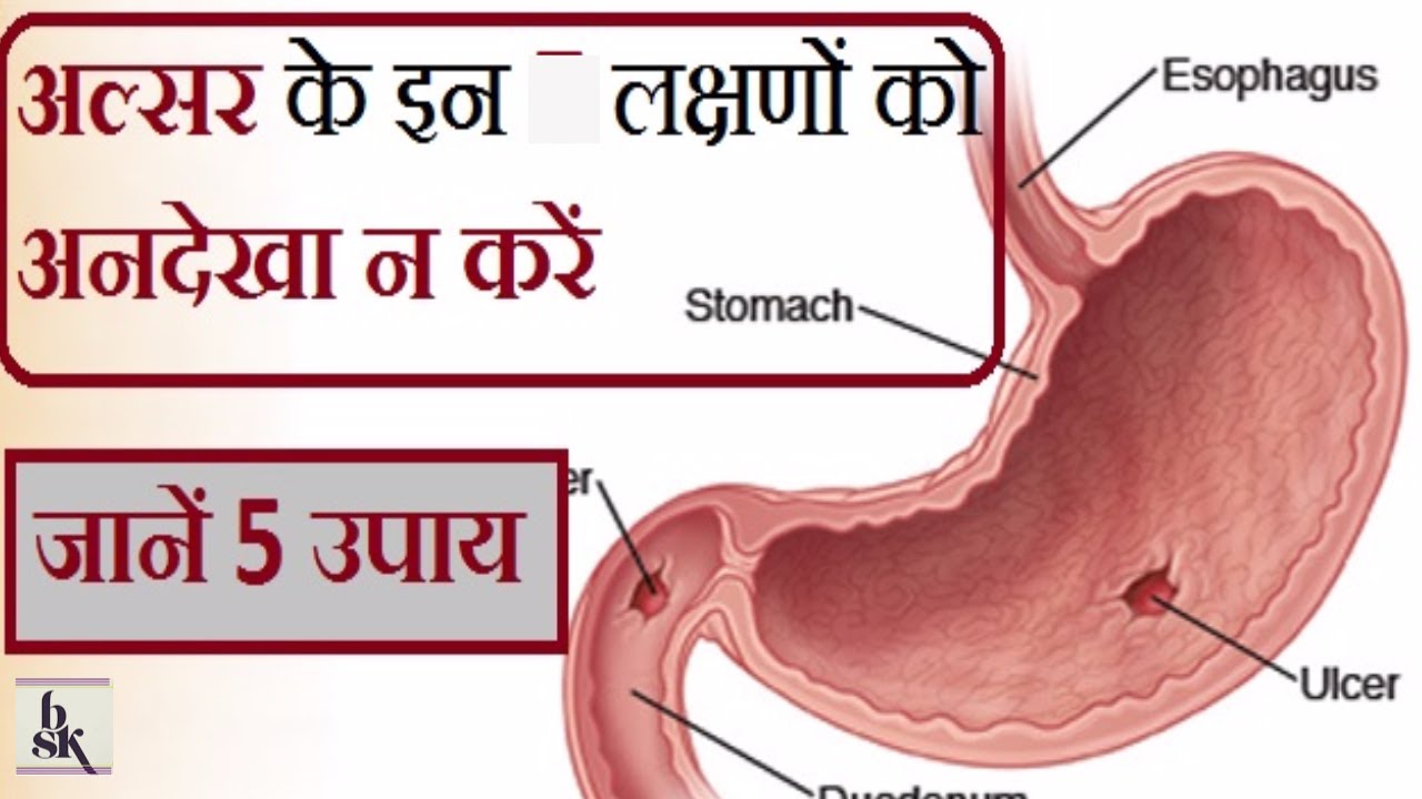 bleeding gums hiv गाजर का ये प्रयोग कभी नहीं होने देगा पेट का अल्सर I