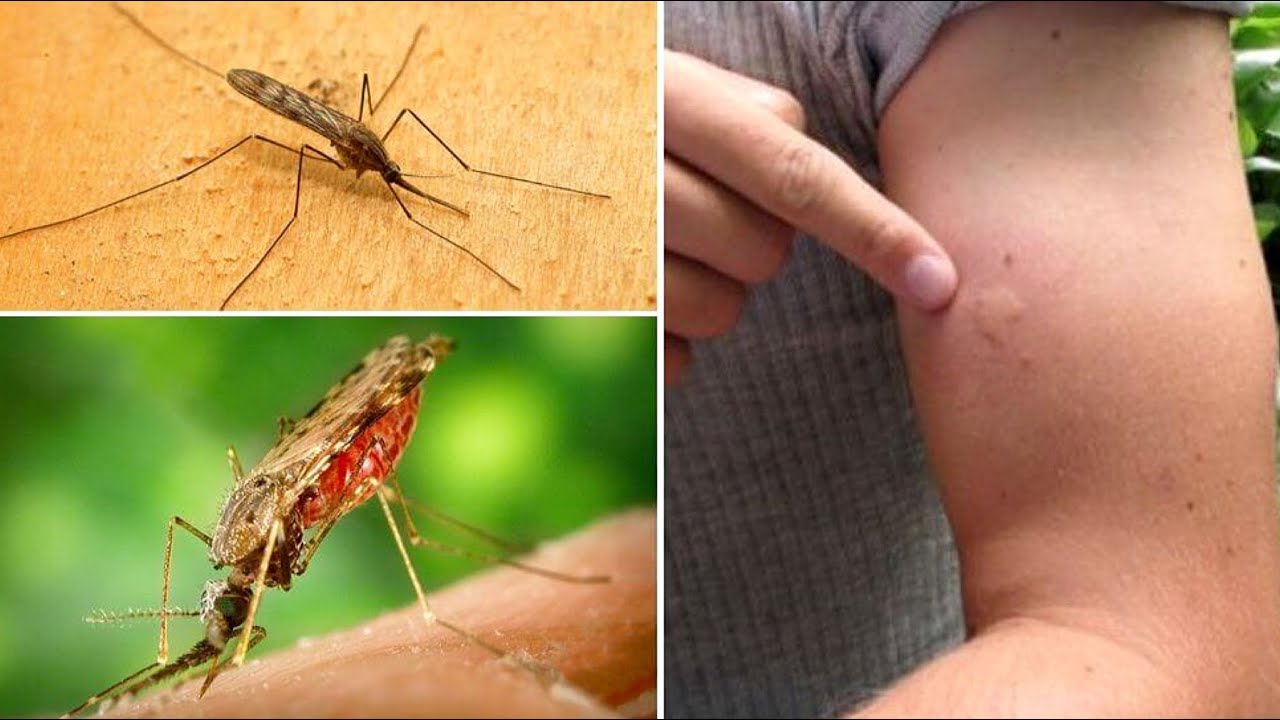 Малярия укусы комаров. Малярийный комар и малярия. Укус Малери малярийный комар. Малярийный комар это паразит.