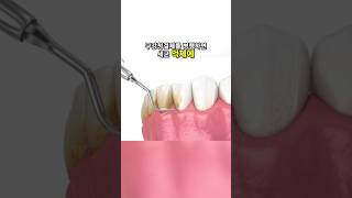 잇몸 건강을 위한 홈케어 비법 공개