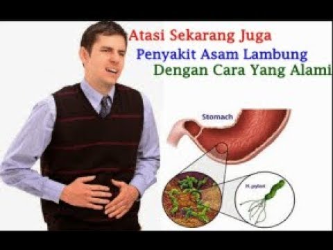 Cara Mengobati Maag Atau Asam Lambung dengan Bahan Alami 