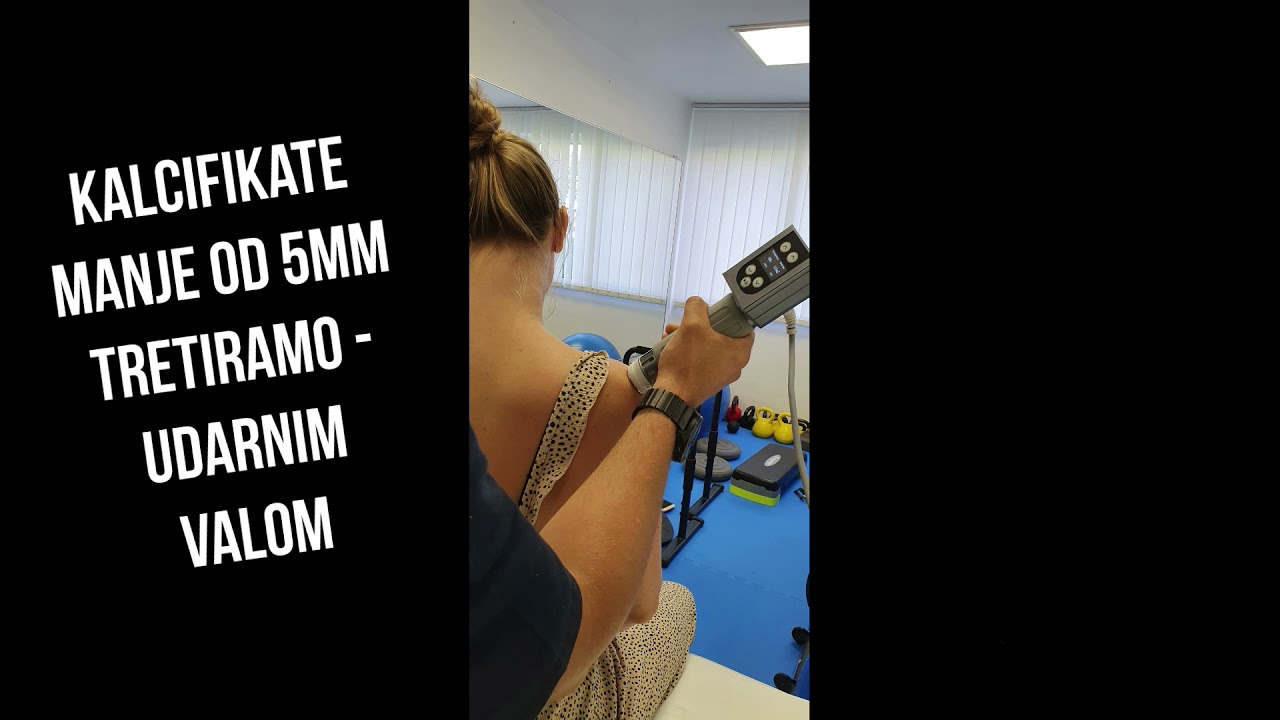 Ispiranje kalcifikata u ramenu - YouTube