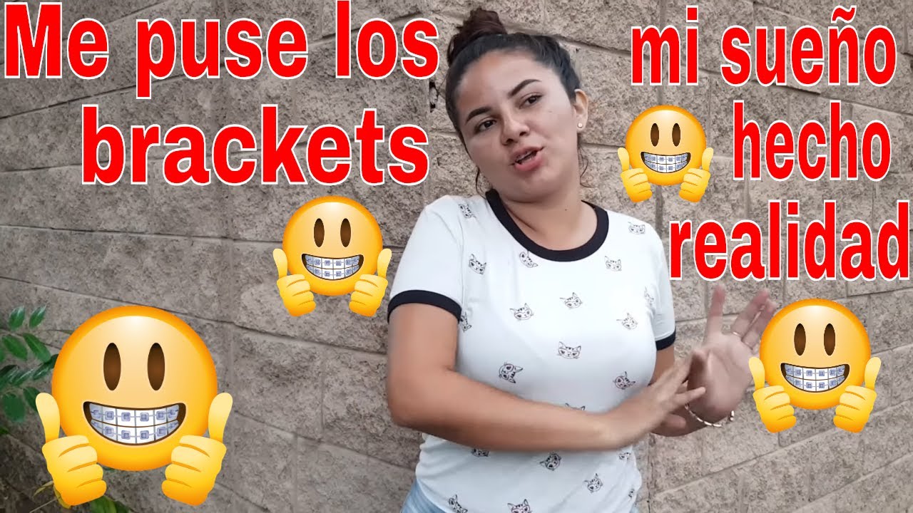 roxana ac odyssey Cambio total poniendome los Brackets OMG
