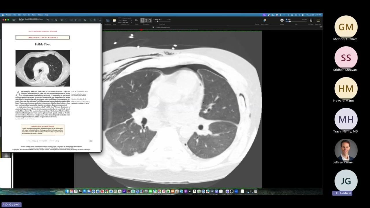 Cardiothoracic case webinar 1/29/2026