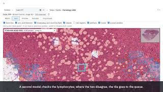 MuFFLe  : an evidence-linked breast cancer patient file with Nemotron agents and NVIDIA FLARE