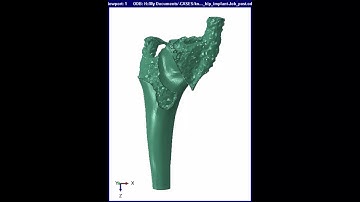 Optimization of a hip implant done with SIMULIA Abaqus & Tosca