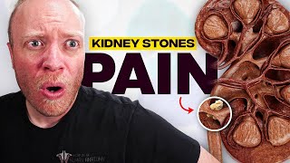 The Most PAINFUL Thing a Human Can Experience?? | Kidney Stones screenshot 2