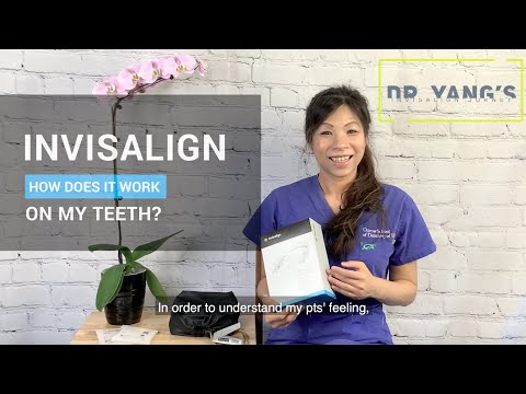 How does Invisalign work on my teeth (Day 0)?  _Dr. Yang's Invisalign Journey (1)