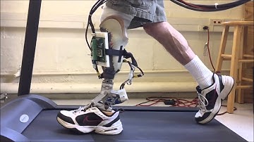 UMass MRRL Active Alignment Prosthesis