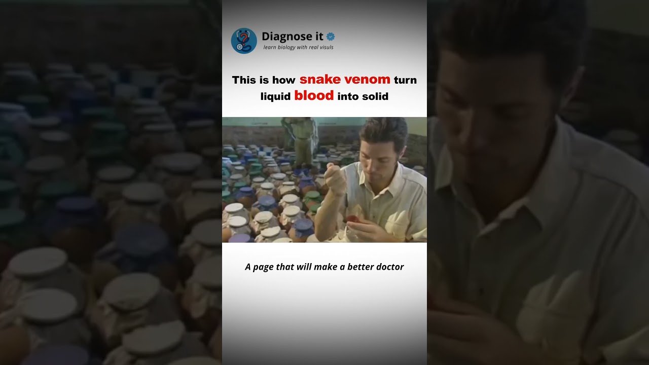 How snake venom turns liquid blood into solid 