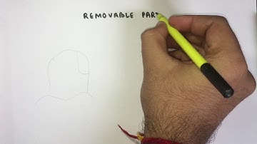 Removable Partial Denture (RPD) -part 1