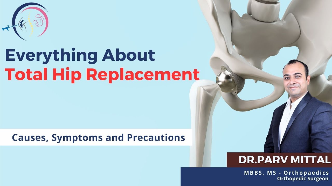 Everything About Total Hip Replacement Causes, Symptoms and