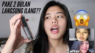 MATA PANDA HILANG CUKUP SATU KALI PUMP AJA?? | LACOCO EYE SERUM!