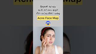 Acne Face Map #healthtips #beautytips #viral #sinhala