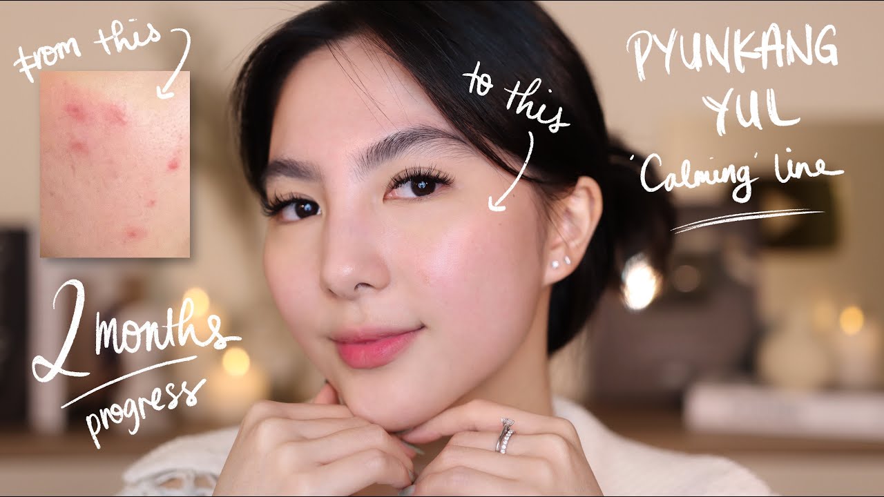 Skincare Ampuh Perbaiki Skin Barrier & Tekstur Kulit | Review Pyunkang