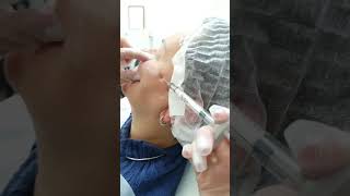 Коллагеностимуляция Фейстем ( Ю. Корея) , препарат на основе гидроксиапатита кальция.