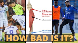 Expert Explains Karim Benzema Injury (Soleus) | 4 Things To Know