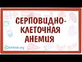 Серповидно-клеточная анемия  — причины, симптомы, патогенез, диагностика, лечение