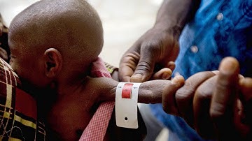 UNICEF steps up emergency response in Chad