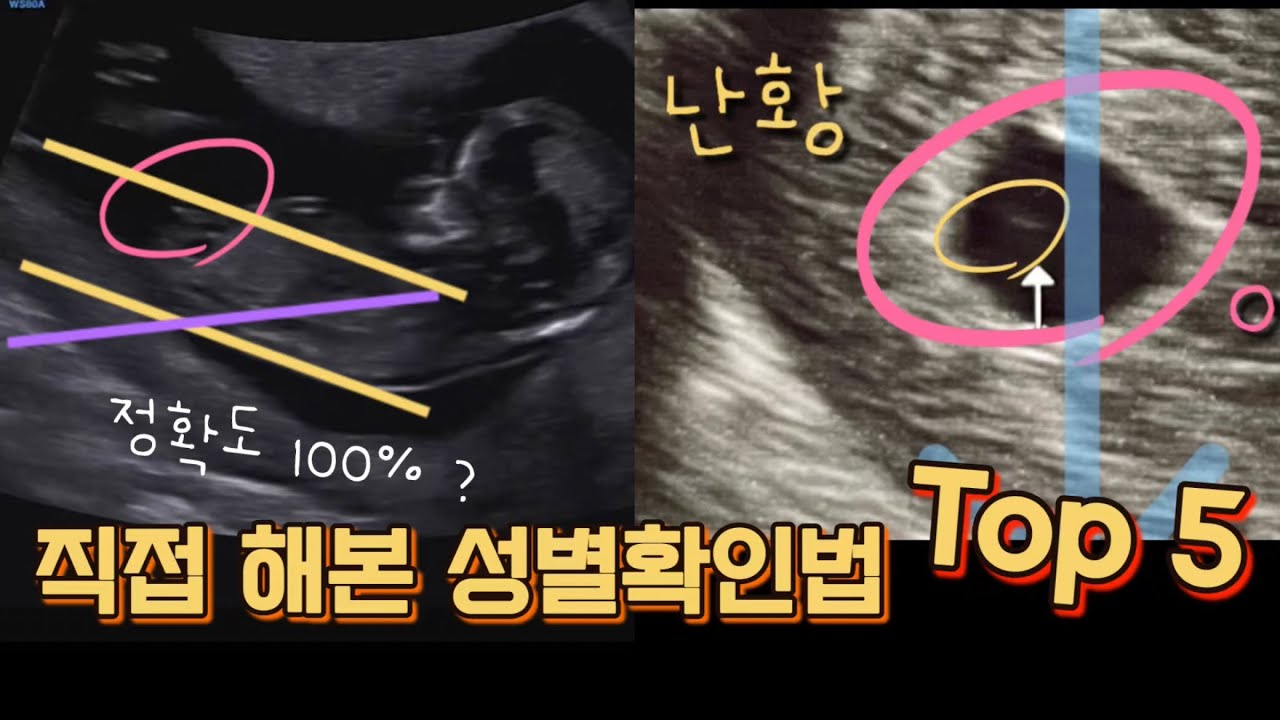 [3만명 시청🎉] 직접 테스트한 태아 성별구별법! (난황위치, 베이킹소다성별, 각도법, 심장소리 기차vs말발굽,  황실달력)｜12주 성별 반전?｜진짜 성별을 공개합니다