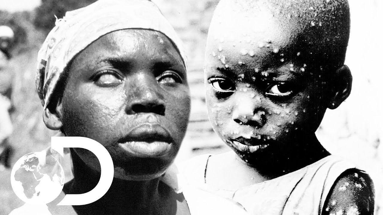 public health salary The Eradication Of Smallpox | Invisible Killers