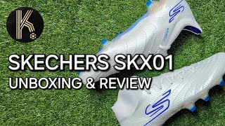 Skechers SKX01 | Before You Buy