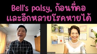 ชาวไทยใหญ่บำบัดโรคหน้าเบี้ยวครึ่งซีก Bell's palsy ก้อนที่คอ และอีกหลายโรค ด้วยตัวเองหายได้หมด