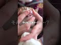 前歯、2本。（異常なしです）
