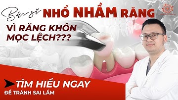 Nhổ Nhầm Răng 7 Vì Răng Khôn Mọc Lệch: Hiểu Đúng Để Tránh Sai Lầm!| Nha khoa Sdental